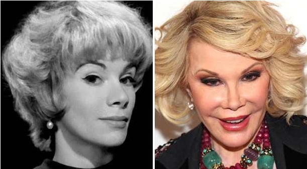 JoanRivers-before-after.jpg